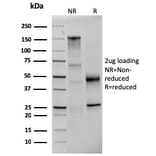 SDS-PAGE - Anti-Prolactin Antibody [PRL/2642] (A249734) - Antibodies.com