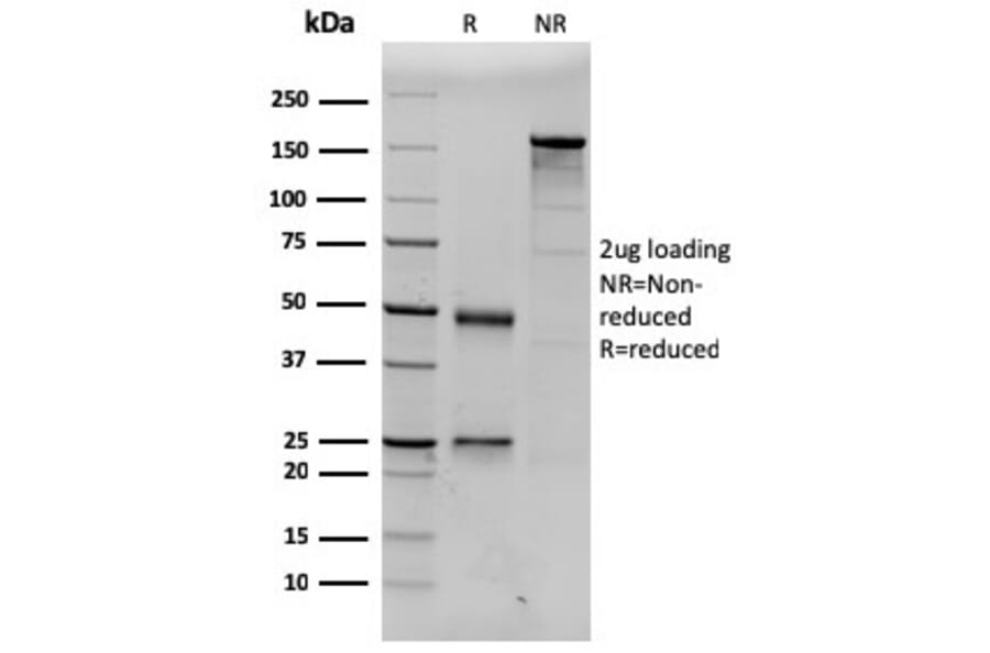 SDS-PAGE - Anti-Prolactin Antibody [PRL/2643] (A249735) - Antibodies.com