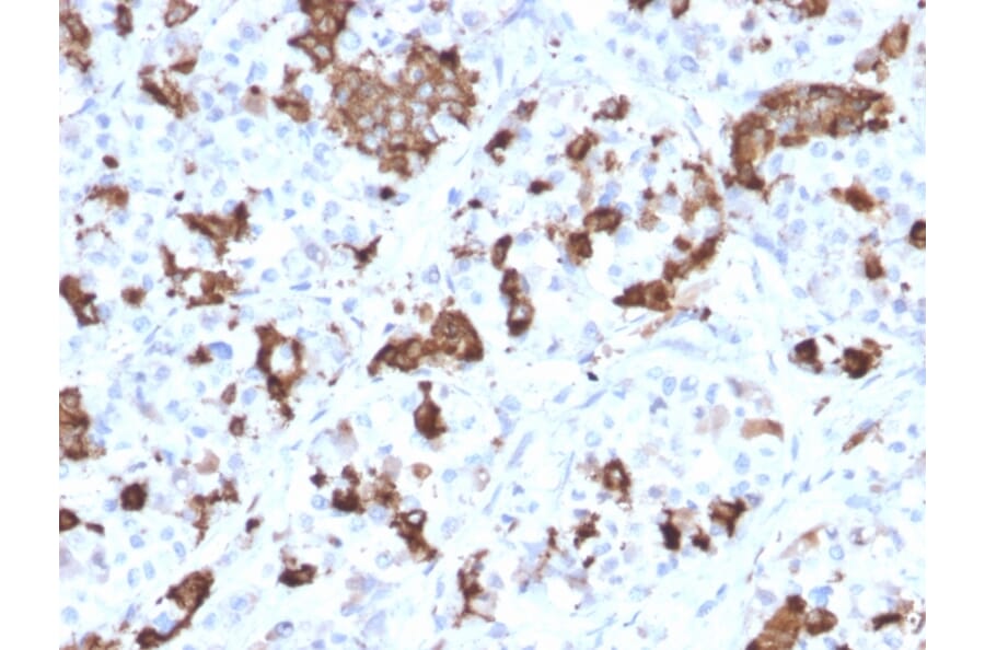 Immunohistochemistry - Anti-Prolactin Antibody [PRL/2644] (A249736) - Antibodies.com