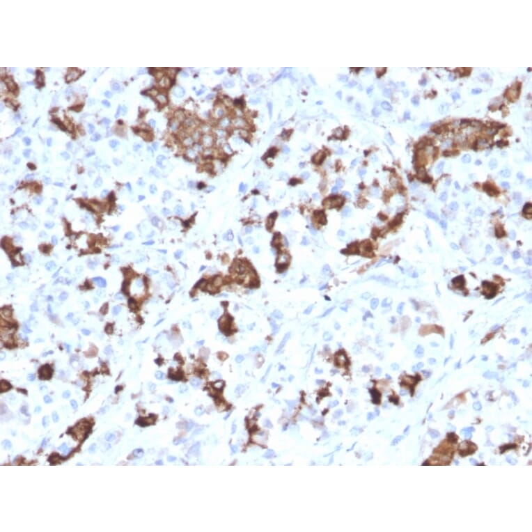 Immunohistochemistry - Anti-Prolactin Antibody [PRL/2644] (A249736) - Antibodies.com