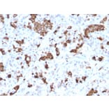 Immunohistochemistry - Anti-Prolactin Antibody [PRL/2644] (A249736) - Antibodies.com