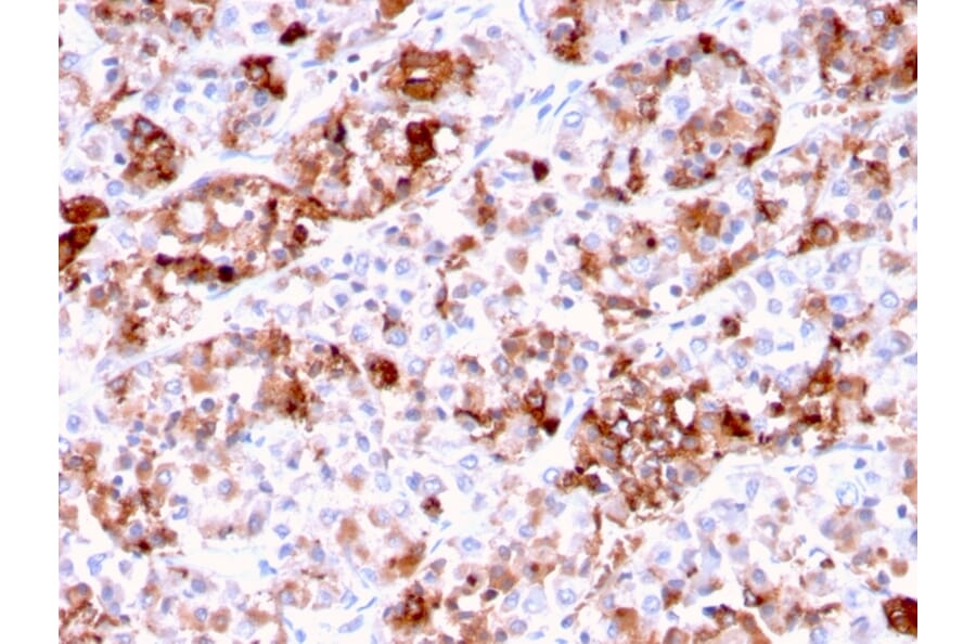 Immunohistochemistry - Anti-Prolactin Antibody [PRL/2644] (A249736) - Antibodies.com