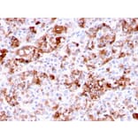 Immunohistochemistry - Anti-Prolactin Antibody [PRL/2644] (A249736) - Antibodies.com