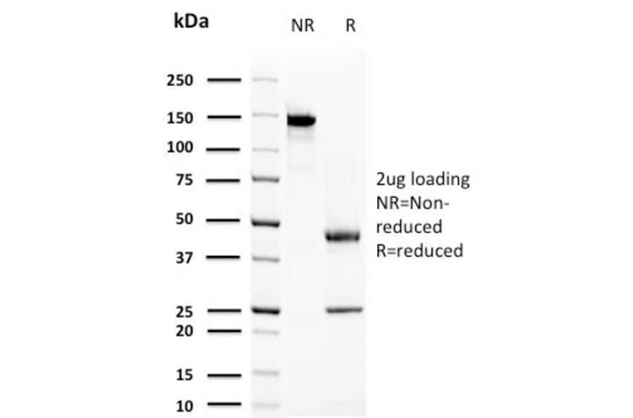 SDS-PAGE - Anti-Prolactin Antibody [PRL/2644] (A249736) - Antibodies.com