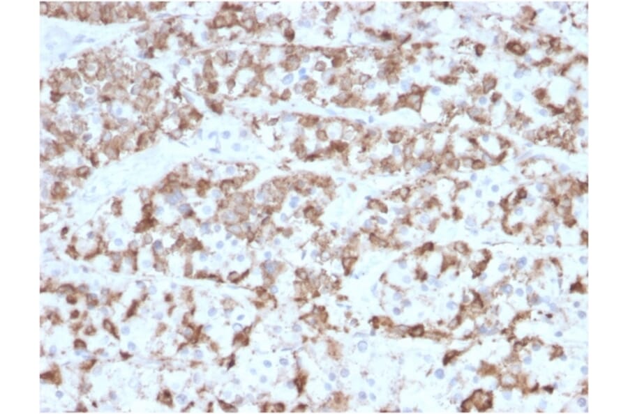 Immunohistochemistry - Anti-Prolactin Antibody [PRL/2910] (A249736) - Antibodies.com