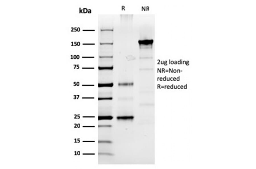 SDS-PAGE - Anti-Prolactin Antibody [PRL/2910] (A249737) - Antibodies.com