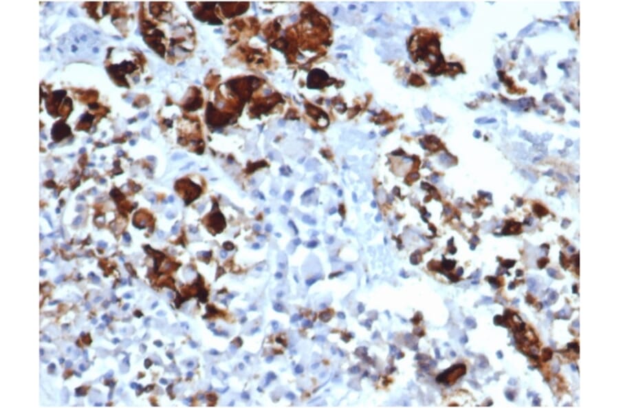 Immunohistochemistry - Anti-Prolactin Antibody [rPRL/4909] (A249737) - Antibodies.com