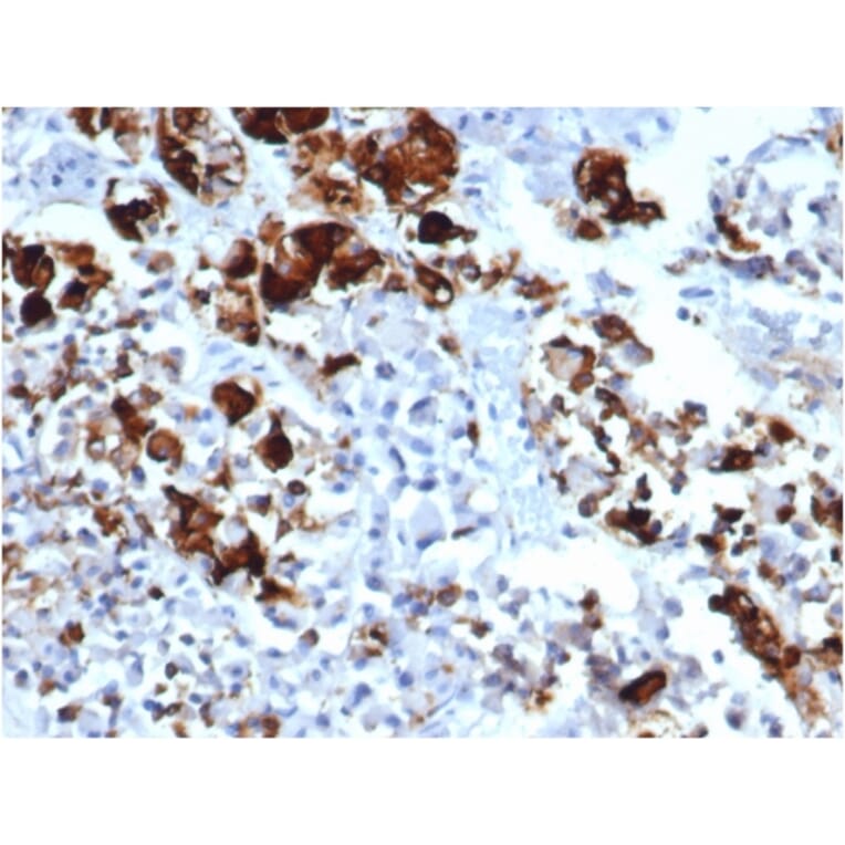 Immunohistochemistry - Anti-Prolactin Antibody [rPRL/4909] (A249737) - Antibodies.com