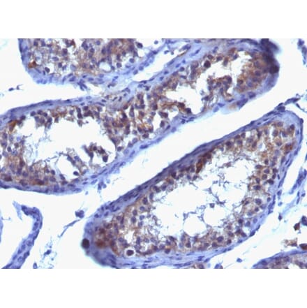 Immunohistochemistry - Anti-Prolactin Receptor Antibody [SPM213] (A249739) - Antibodies.com