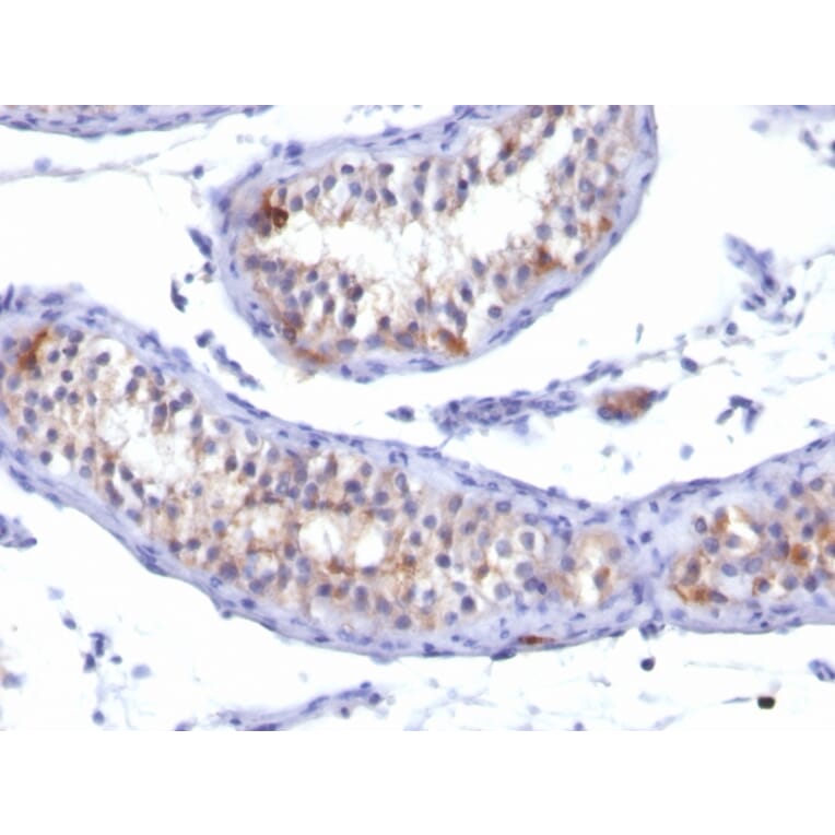 Immunohistochemistry - Anti-Prolactin Receptor Antibody [PRLR/742] (A249740) - Antibodies.com