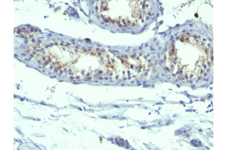 Immunohistochemistry - Anti-Prolactin Receptor Antibody [B6.2 + PRLR742] (A249741) - Antibodies.com