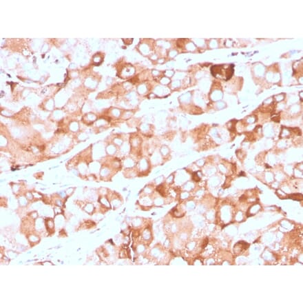 Immunohistochemistry - Anti-Prolactin Receptor Antibody [rPRLR/742] (A249743) - Antibodies.com