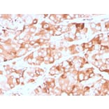 Immunohistochemistry - Anti-Prolactin Receptor Antibody [rPRLR/742] (A249743) - Antibodies.com