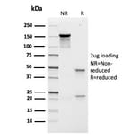 SDS-PAGE - Anti-Prolactin Receptor Antibody [rPRLR/742] (A249743) - Antibodies.com