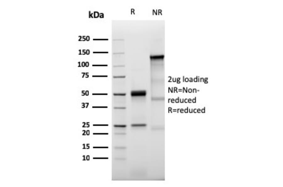 SDS-PAGE - Anti-Prolactin Receptor Antibody [PRLR/3785R] (A249744) - Antibodies.com