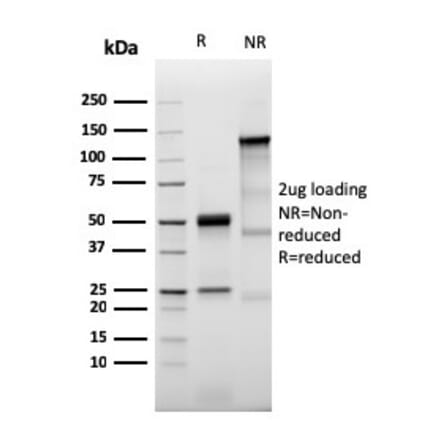 SDS-PAGE - Anti-Prolactin Receptor Antibody [PRLR/3785R] (A249744) - Antibodies.com