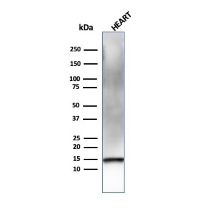 Western Blot - Anti-Resistin Antibody [RETN/4326] (A249745) - Antibodies.com