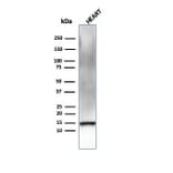 Western Blot - Anti-Resistin Antibody [RETN/4326] (A249745) - Antibodies.com
