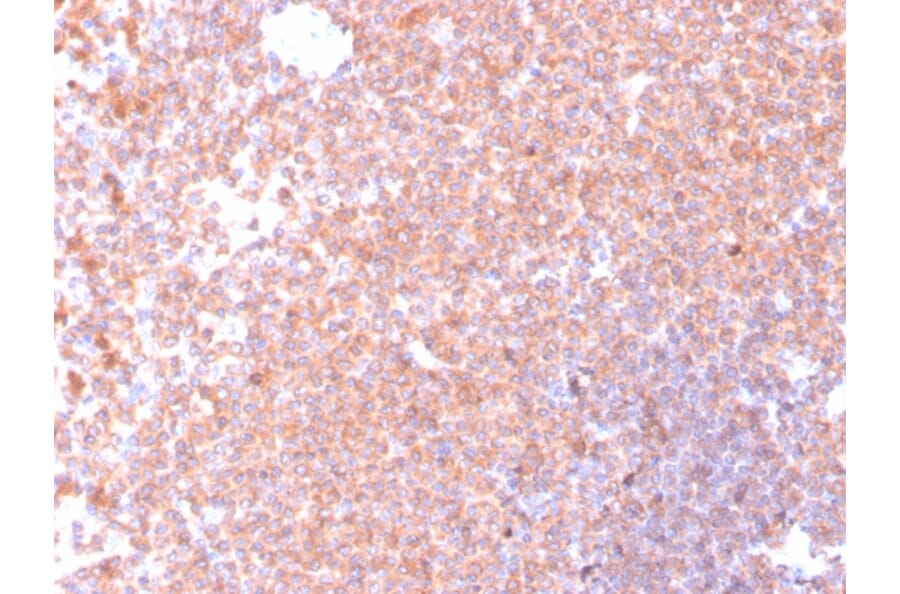 Immunohistochemistry - Anti-Resistin Antibody [RETN/4326] (A249745) - Antibodies.com