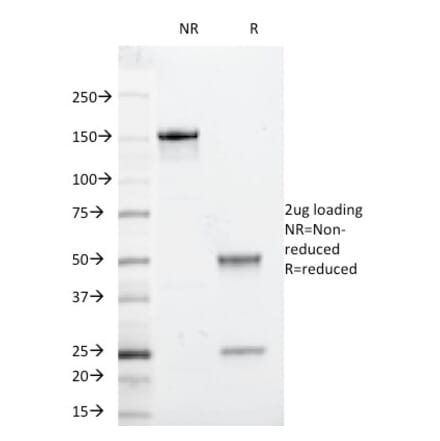 SDS-PAGE - Anti-beta 2 Microglobulin Antibody [246-E9.E7] (A249745) - Antibodies.com