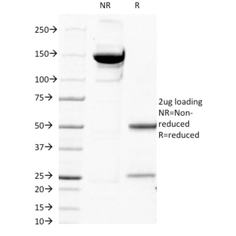 SDS-PAGE - Anti-beta 2 Microglobulin Antibody [B2M/1118] (A249748) - Antibodies.com