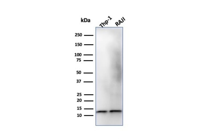 Western Blot - Anti-beta 2 Microglobulin Antibody [B2M/1118] (A249748) - Antibodies.com