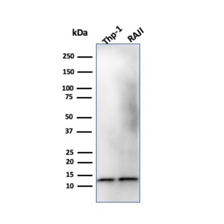 Western Blot - Anti-beta 2 Microglobulin Antibody [B2M/1118] (A249748) - Antibodies.com