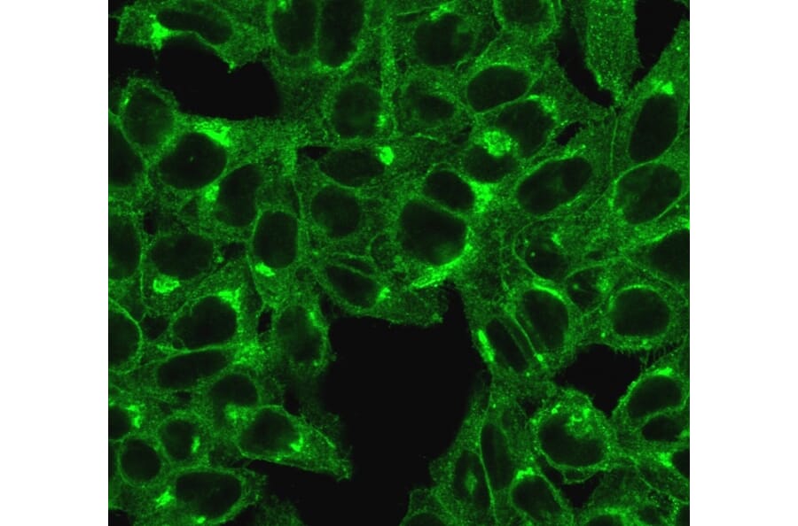 Immunofluorescence - Anti-beta 2 Microglobulin Antibody [SPM617] (A249749) - Antibodies.com