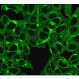 Immunofluorescence - Anti-beta 2 Microglobulin Antibody [SPM617] (A249749) - Antibodies.com