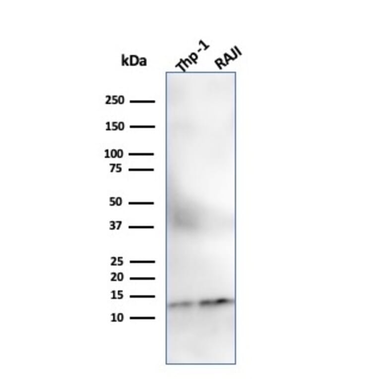 Western Blot - Anti-beta 2 Microglobulin Antibody [SPM617] (A249749) - Antibodies.com