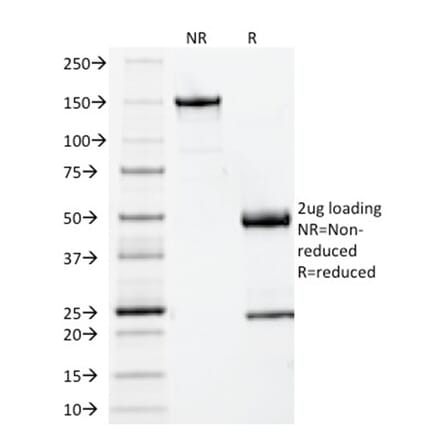 SDS-PAGE - Anti-beta 2 Microglobulin Antibody [BBM.1] (A249750) - Antibodies.com