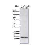 Western Blot - Anti-beta 2 Microglobulin Antibody [BBM.1] (A249750) - Antibodies.com