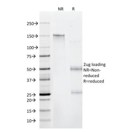 SDS-PAGE - Anti-beta 2 Microglobulin Antibody [C21.48A1] (A249751) - Antibodies.com