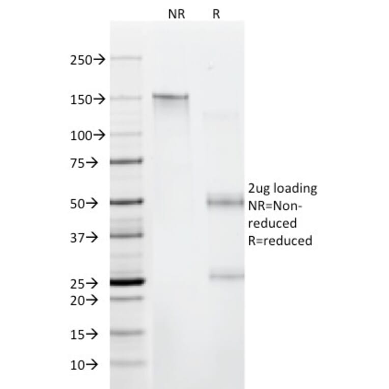 SDS-PAGE - Anti-beta 2 Microglobulin Antibody [C21.48A1] (A249751) - Antibodies.com