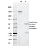SDS-PAGE - Anti-beta 2 Microglobulin Antibody [C21.48A1] (A249751) - Antibodies.com