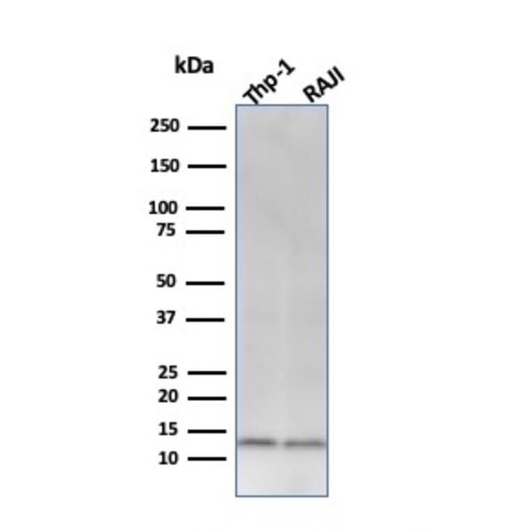 Western Blot - Anti-beta 2 Microglobulin Antibody [C21.48A1] (A249751) - Antibodies.com