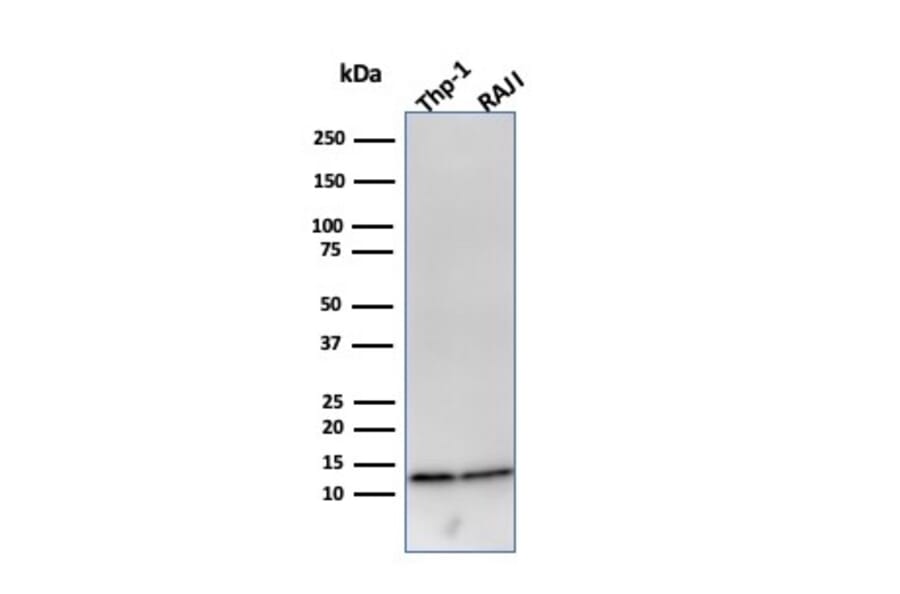 Western Blot - Anti-beta 2 Microglobulin Antibody [B2M/961] (A249752) - Antibodies.com