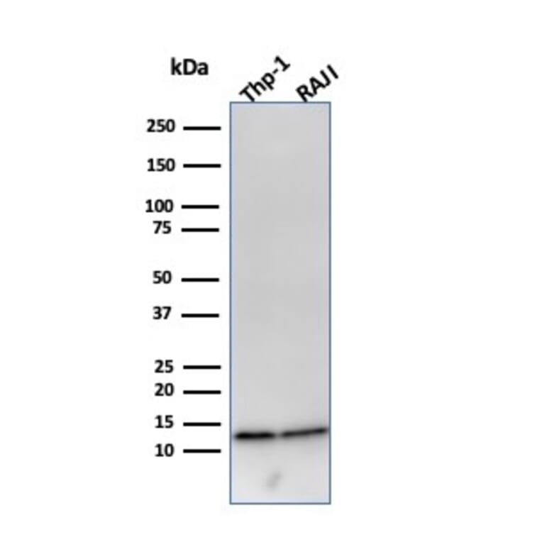 Western Blot - Anti-beta 2 Microglobulin Antibody [B2M/961] (A249752) - Antibodies.com