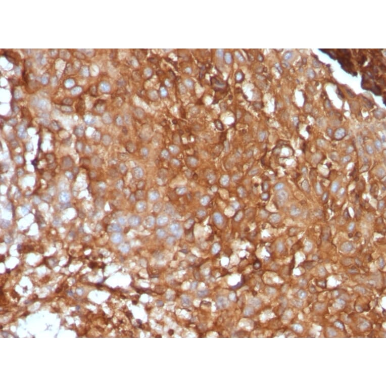 Immunohistochemistry - Anti-beta 2 Microglobulin Antibody [B2M/961] (A249752) - Antibodies.com