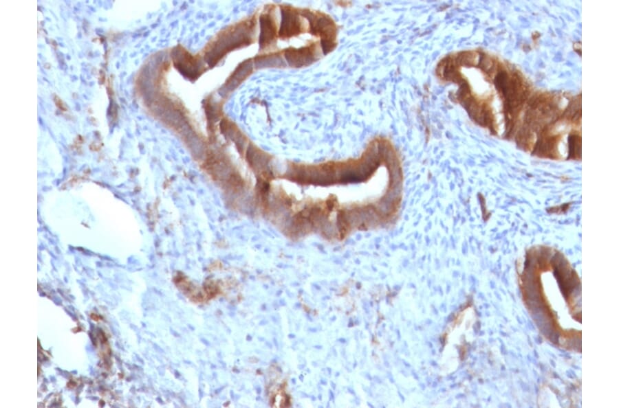 Immunohistochemistry - Anti-beta 2 Microglobulin Antibody [B2M/961] (A249752) - Antibodies.com