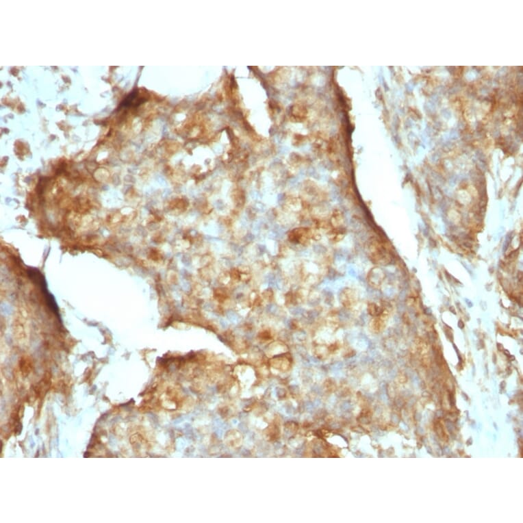 Immunohistochemistry - Anti-beta 2 Microglobulin Antibody [B2M/961] (A249752) - Antibodies.com