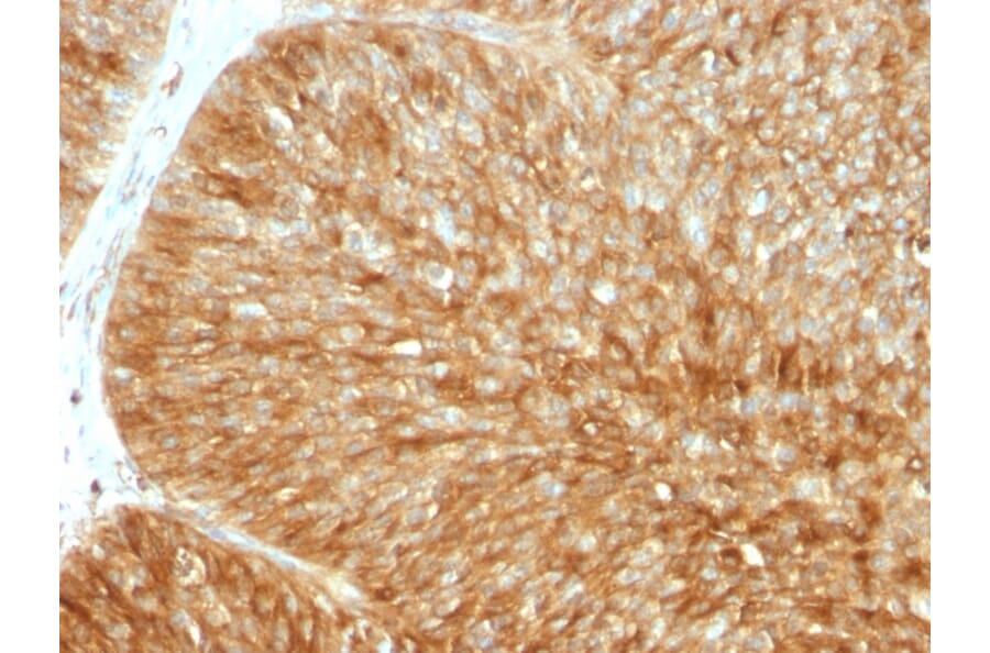 Immunohistochemistry - Anti-beta 2 Microglobulin Antibody [B2M/961] (A249752) - Antibodies.com
