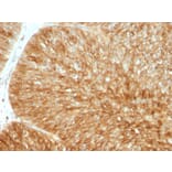 Immunohistochemistry - Anti-beta 2 Microglobulin Antibody [B2M/961] (A249752) - Antibodies.com