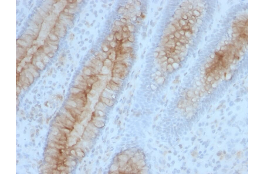 Immunohistochemistry - Anti-beta 2 Microglobulin Antibody [B2M/961] (A249752) - Antibodies.com