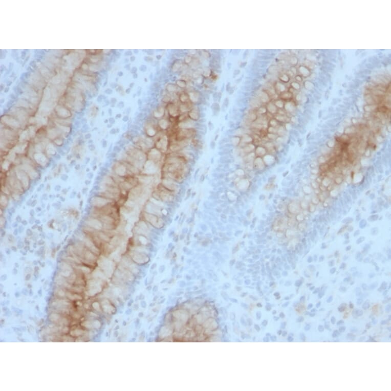 Immunohistochemistry - Anti-beta 2 Microglobulin Antibody [B2M/961] (A249752) - Antibodies.com