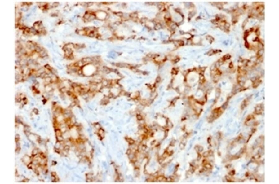 Immunohistochemistry - Anti-beta 2 Microglobulin Antibody [rB2M/961] (A249753) - Antibodies.com