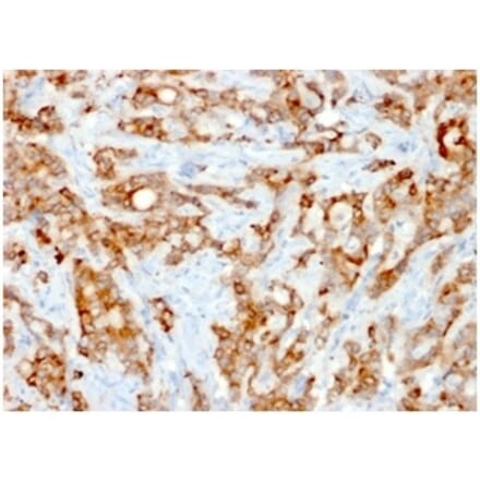 Immunohistochemistry - Anti-beta 2 Microglobulin Antibody [rB2M/961] (A249753) - Antibodies.com