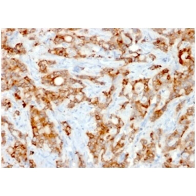 Immunohistochemistry - Anti-beta 2 Microglobulin Antibody [rB2M/961] (A249753) - Antibodies.com
