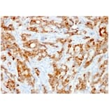 Immunohistochemistry - Anti-beta 2 Microglobulin Antibody [rB2M/961] (A249753) - Antibodies.com