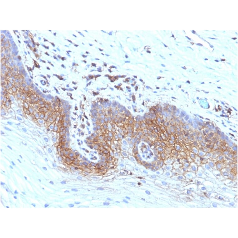 Immunohistochemistry - Anti-beta 2 Microglobulin Antibody [rB2M/961] (A249753) - Antibodies.com